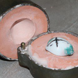 Sarl Bornert Protheses Oculaires Strasbourg Img 3